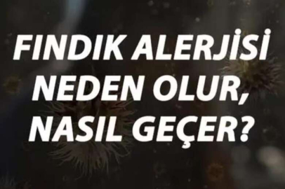 Fındık Alerjisi Nedir, Neden Olur Ve Nasıl Geçer?