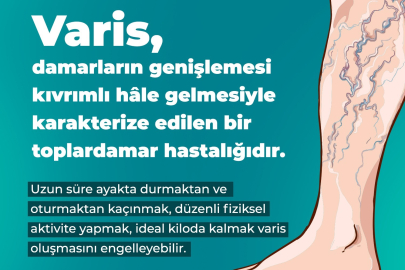 VARİS OLUŞUMU NASIL ÖNLENİR?