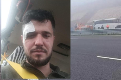 ORDULU EMİR KAZADA YARALANDI