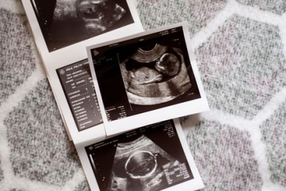 DOĞUM İZNİNE YENİ DÜZENLEME